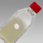 Agar