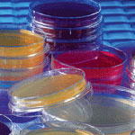 Contact Plates